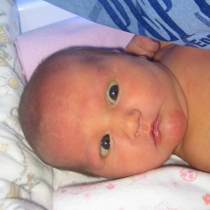 Cross Eyed Baby